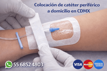 nuncio de colocación de catéter periférico a domicilio en CDMX con fijación transparente, número 5568524803 y pago con Visa, MasterCard y American Express