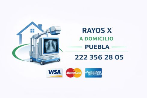 Logotipo de rayos X a domicilio en Puebla con equipo portátil de radiografía, número telefónico 222 356 28 05 y aceptación de Visa, MasterCard y American Express