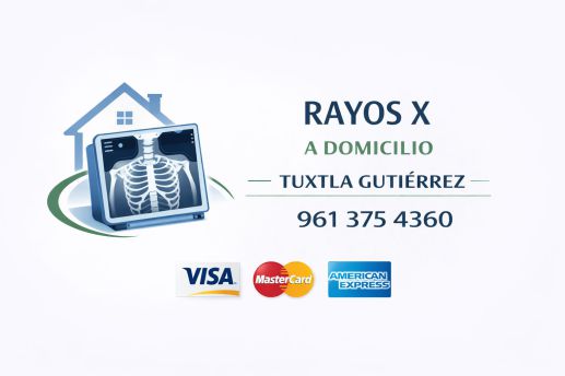 Logotipo de rayos X a domicilio en Tuxtla Gutiérrez con equipo portátil de radiografía, número telefónico 961 375 4360 y aceptación de Visa, MasterCard y American Express