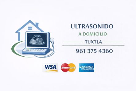 Logotipo de ultrasonido a domicilio en Tuxtla con equipo portátil, número telefónico 961 375 4360 y aceptación de Visa, MasterCard y American Express
