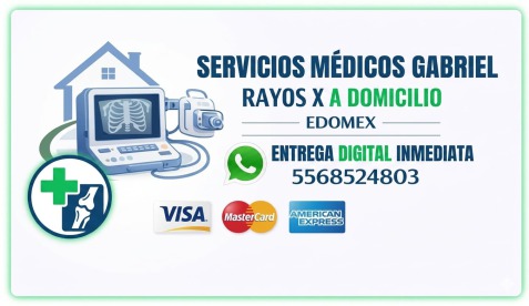 Rayos X a domicilio en el Estado de México